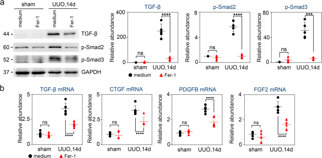 AAV9小鼠肾脏实验：UUO期间TGF-β/Smad信号激活通过Fer-1抑制TEC铁死亡