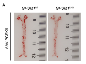 GPSM1缺失减轻了AAV-PCSK9诱导的动脉粥样硬化