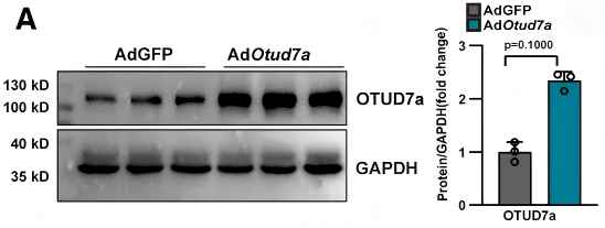 Ad-OTUD7a转导的新生大鼠心肌细胞中OTUD7a成功过表达