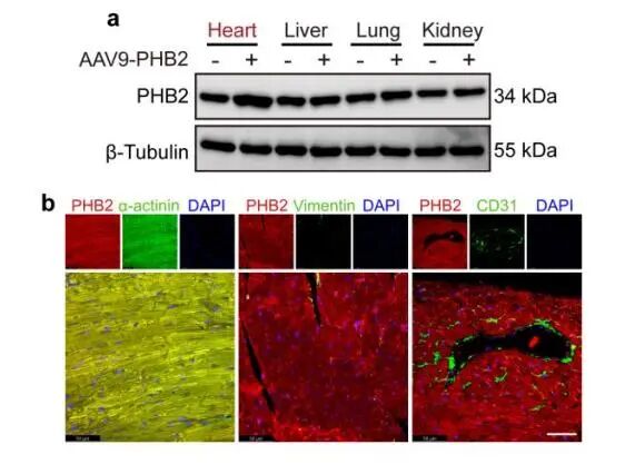 AAV9-cTnT-PHB2介导PHB2在小鼠心肌细胞特异性表达